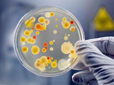 Gloved hand holding a bacteria culture on an agar plate, photo by AndreasReh/Getty Images